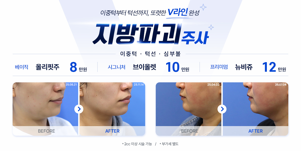 지방파괴주사
