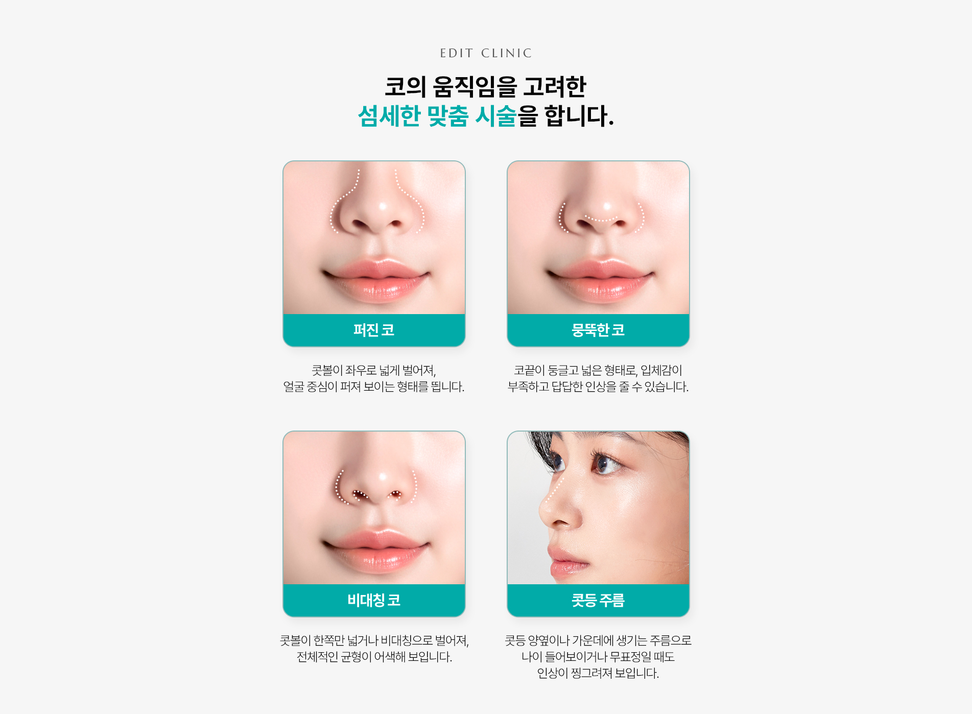 섬세한 맞춤 시술
