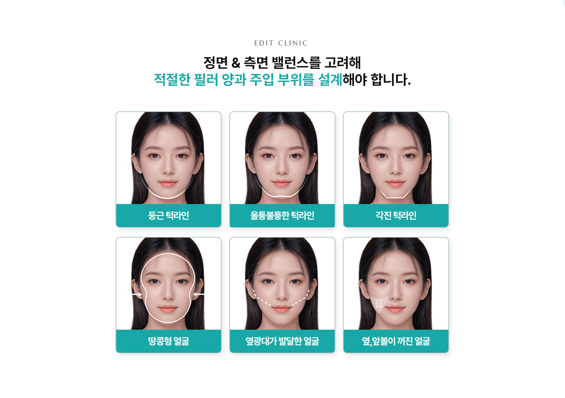 볼/턱라인필러 시 고려사항