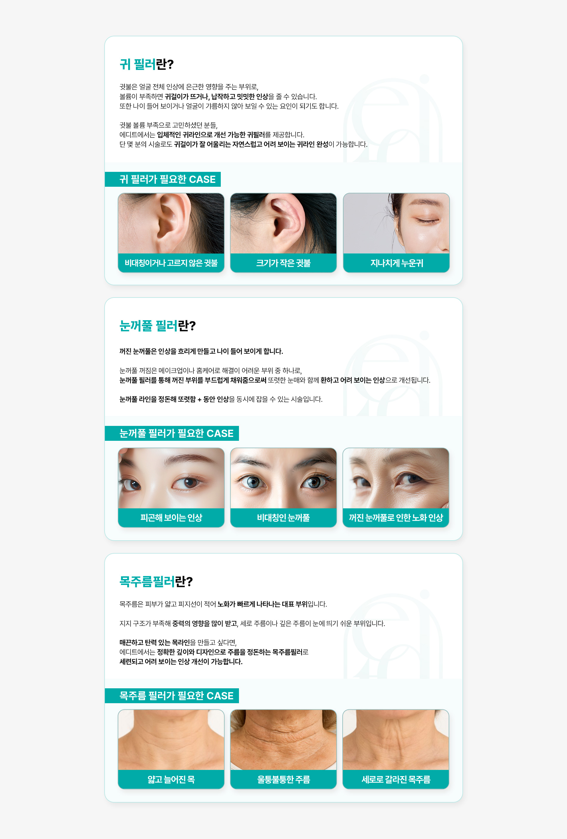 특수부위필러 03