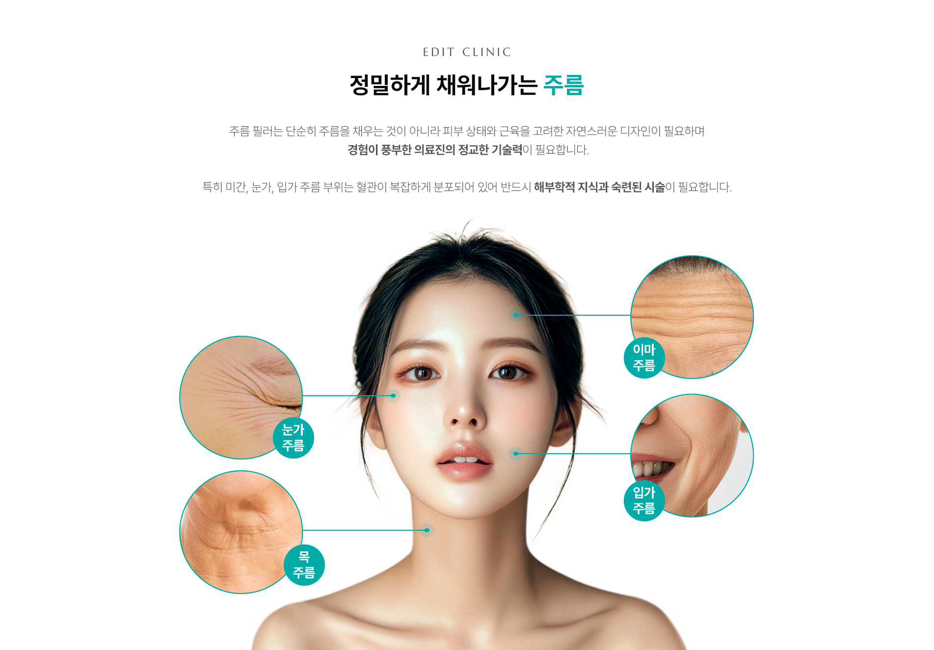 주름필러 시 중요성