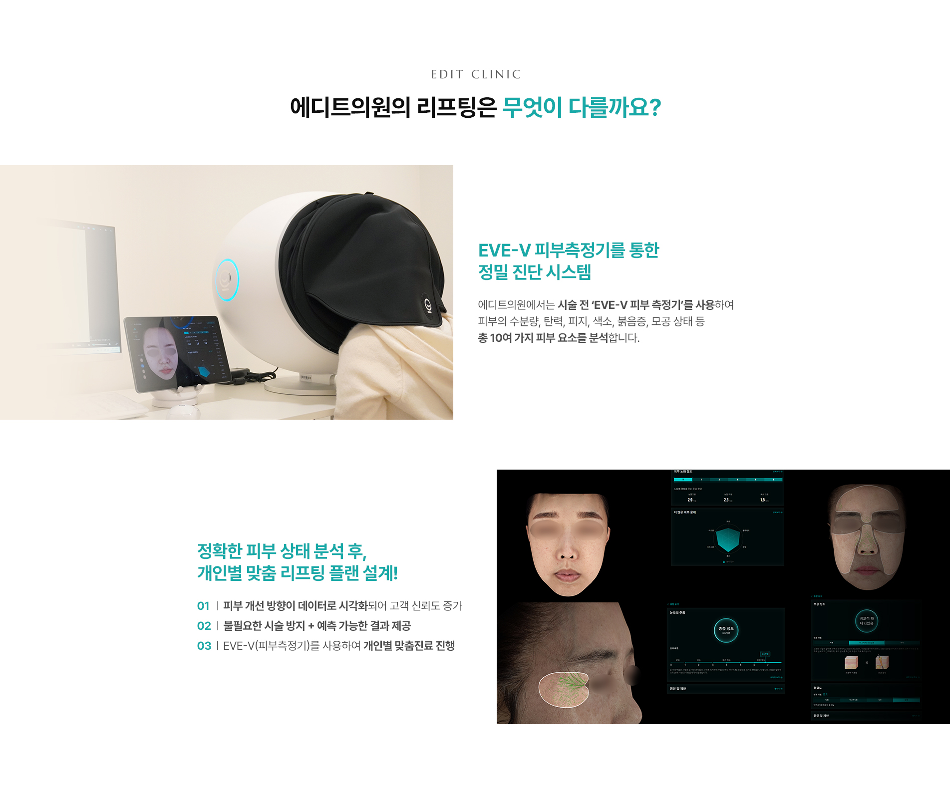 세르프 리프팅 무엇이 다를까요