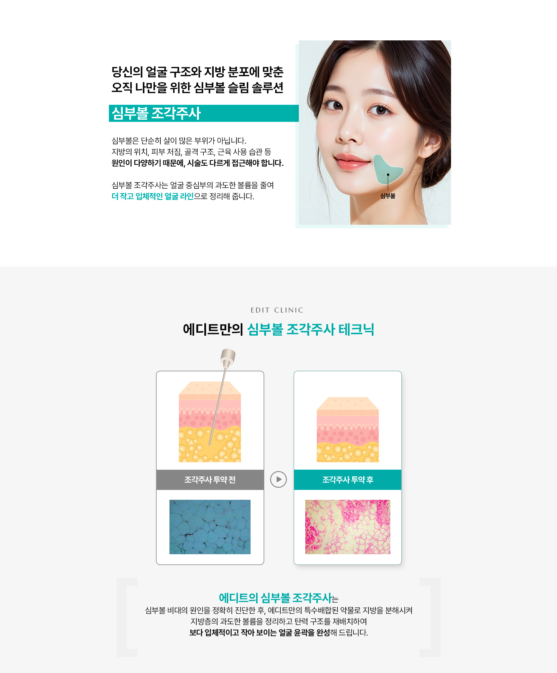 심부볼조각주사02