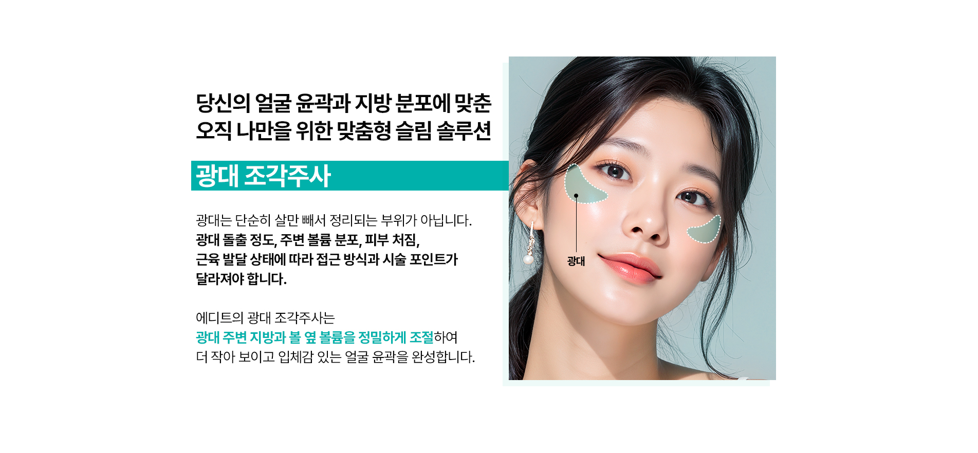 광대조각주사란