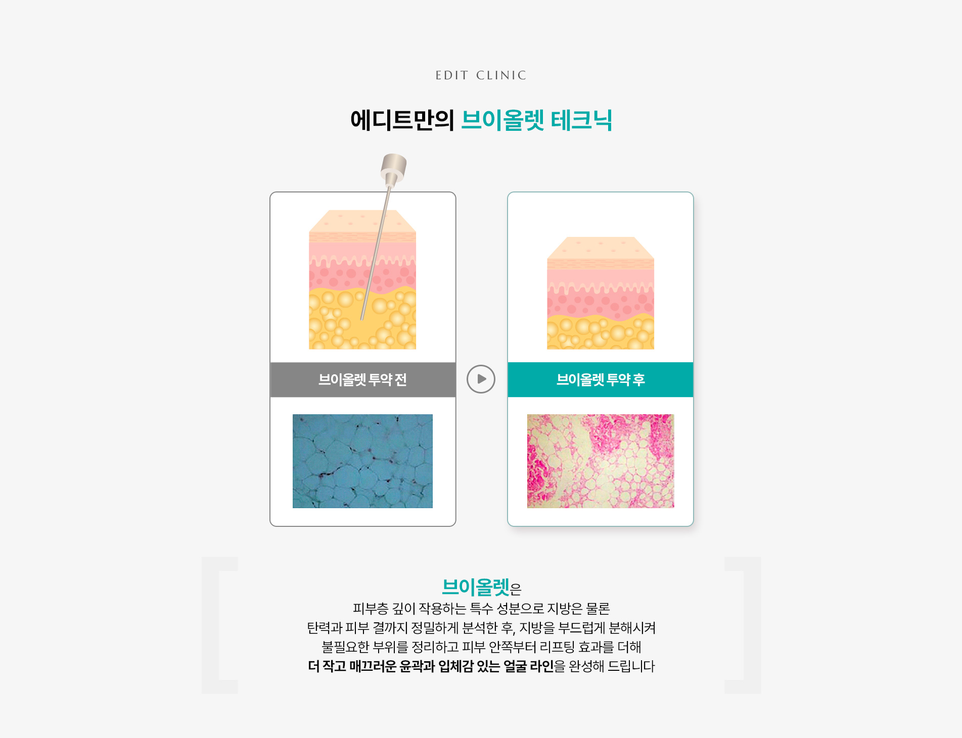 브이올렛의 효과