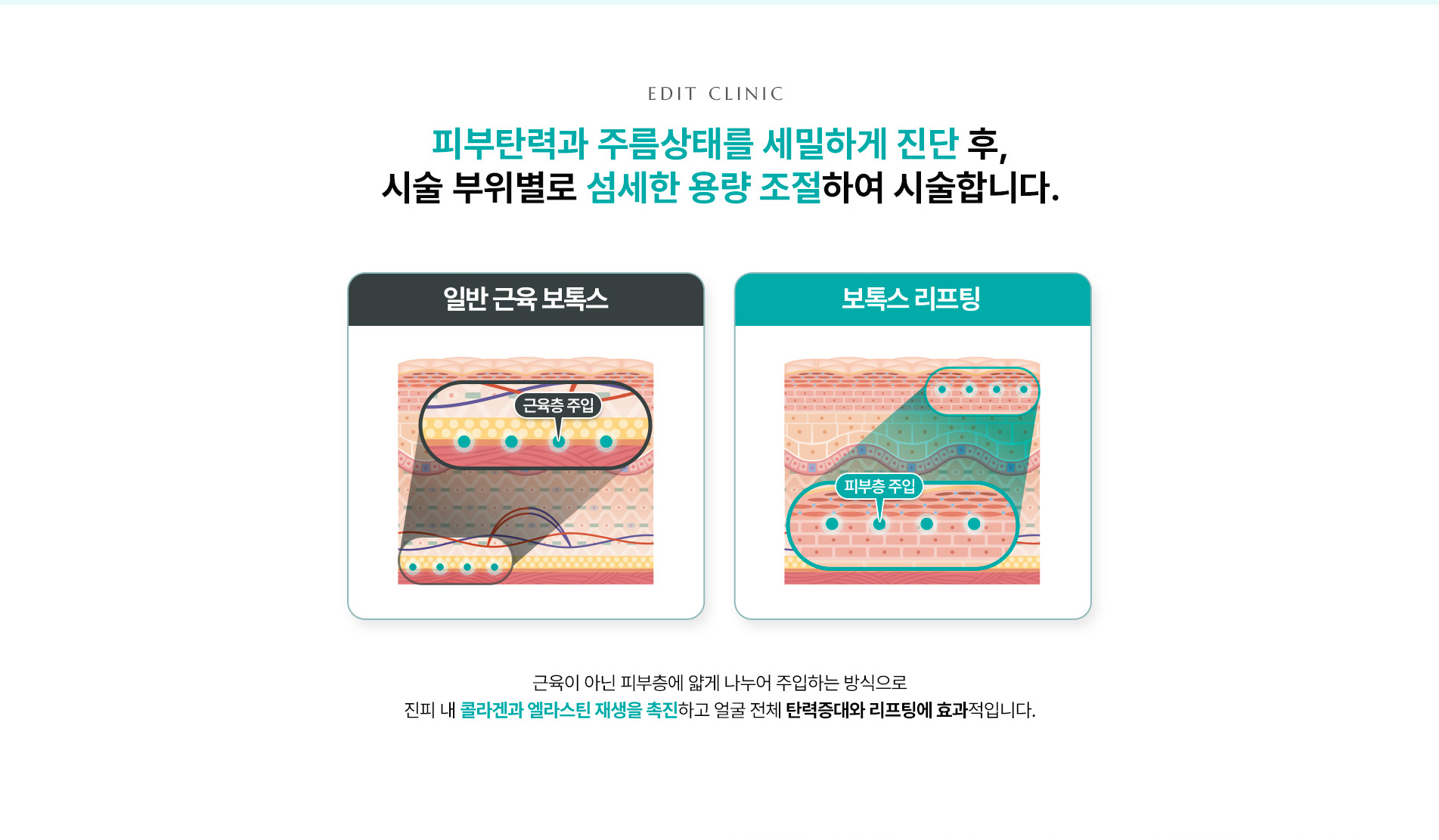 리프팅보톡스 3