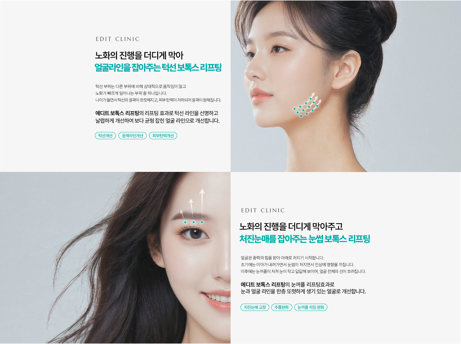 리프팅보톡스 4