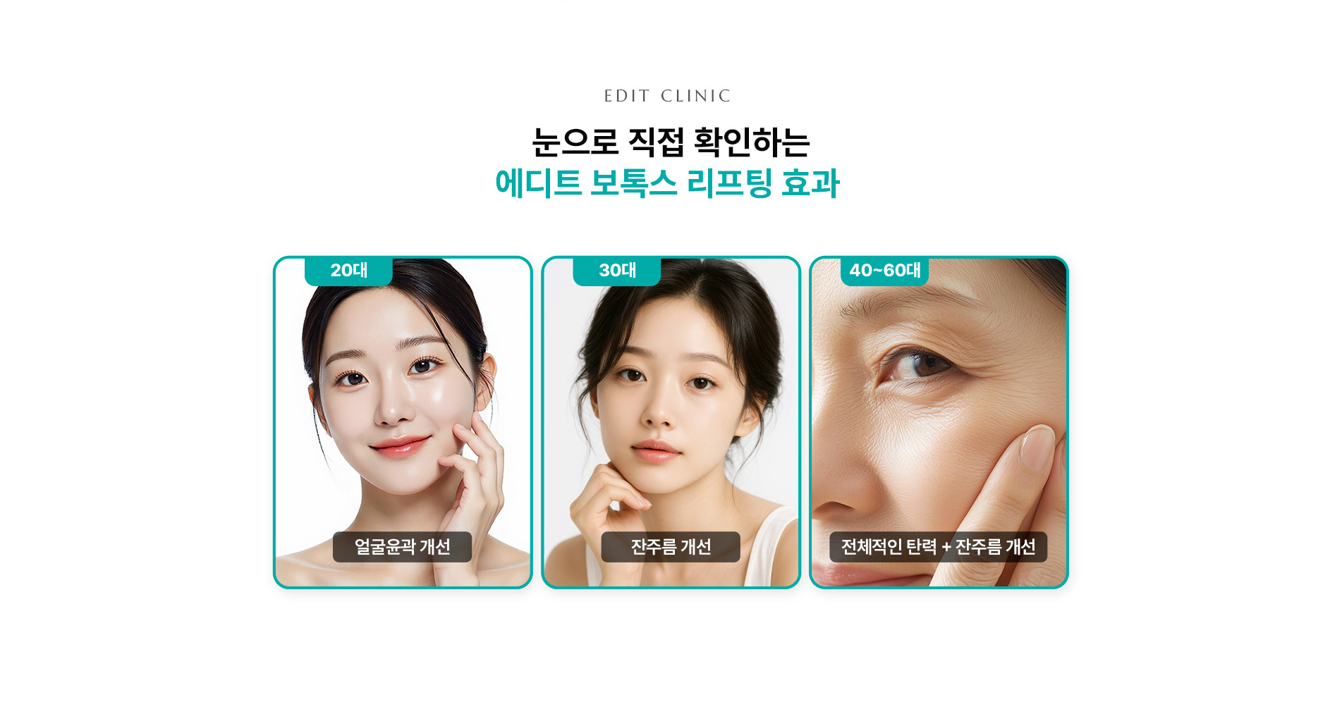 리프팅보톡스 5