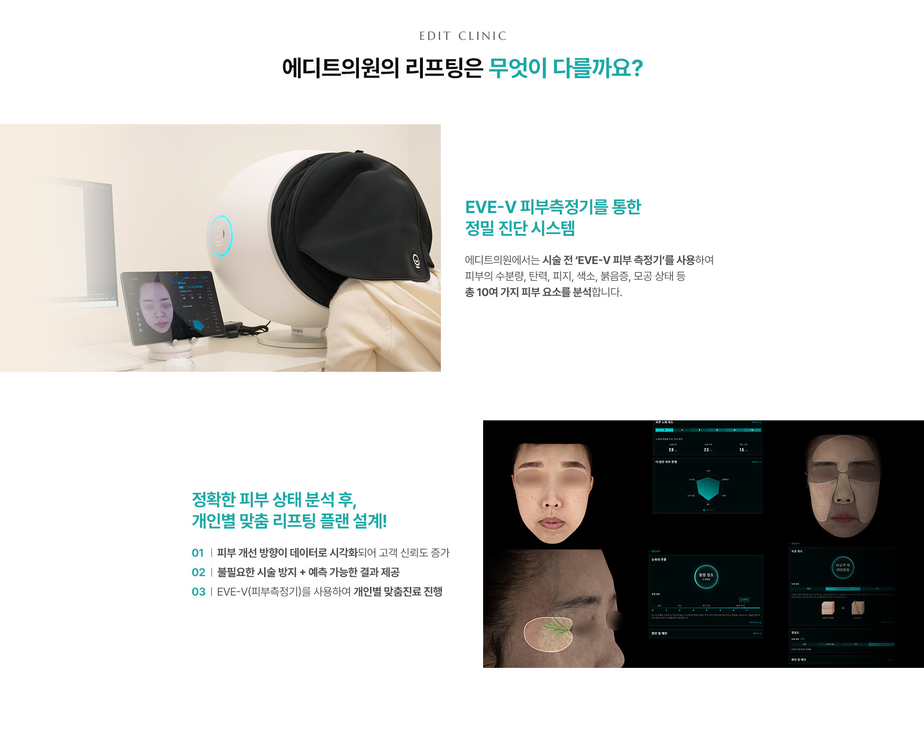조각 리프팅 무엇이 다를까요