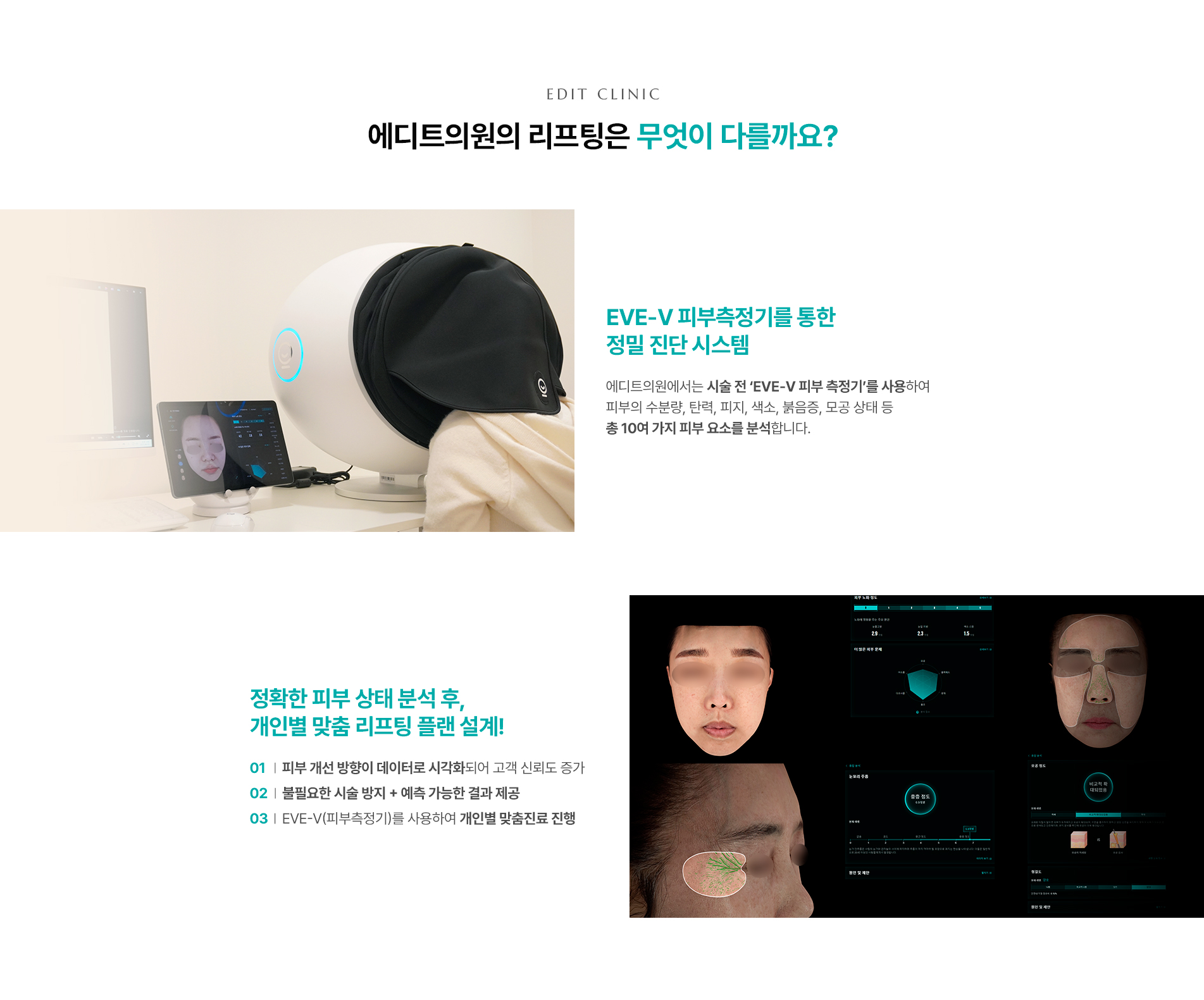 실리프팅 무엇이 다를까요