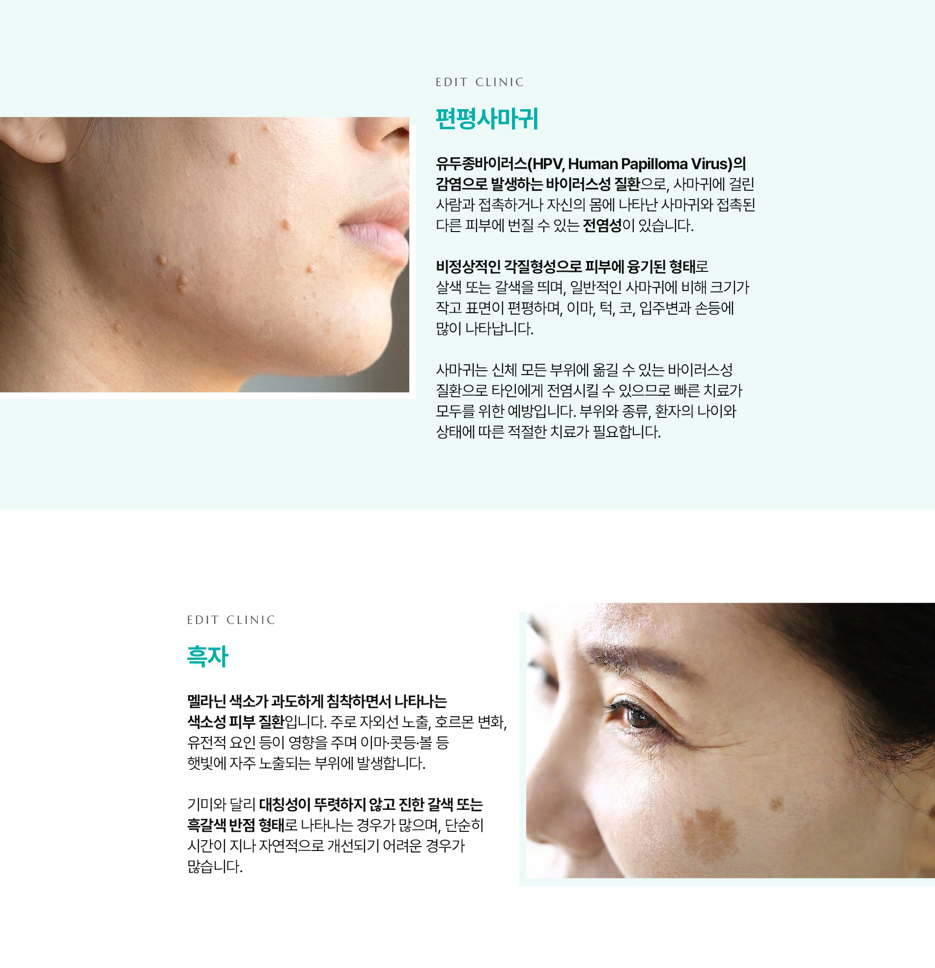 lesion 03