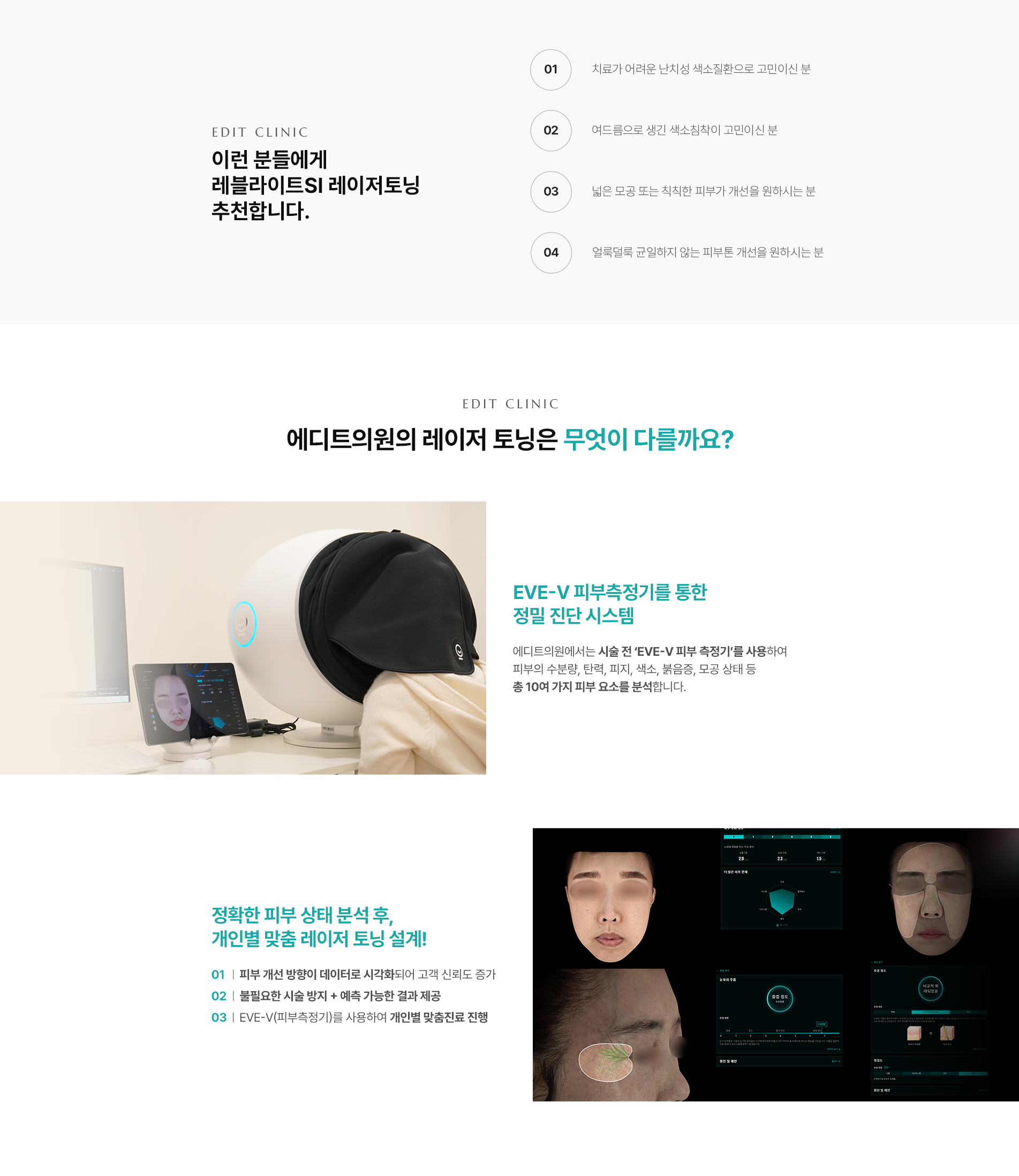 레블라이트SI 레이저토닝06