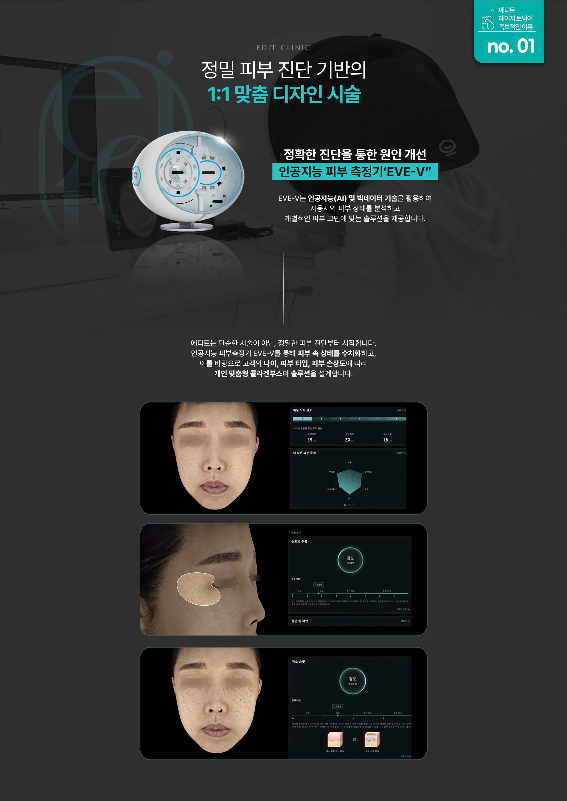 레블라이트SI 레이저토닝09