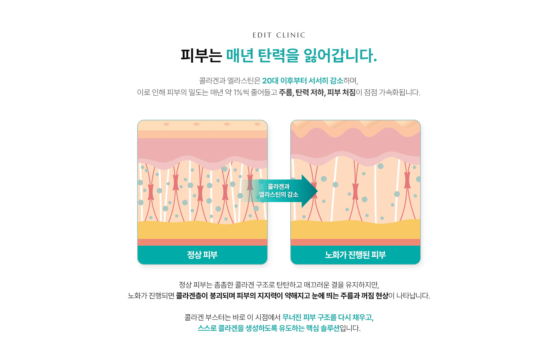 매년 탄력을 잃는 피부