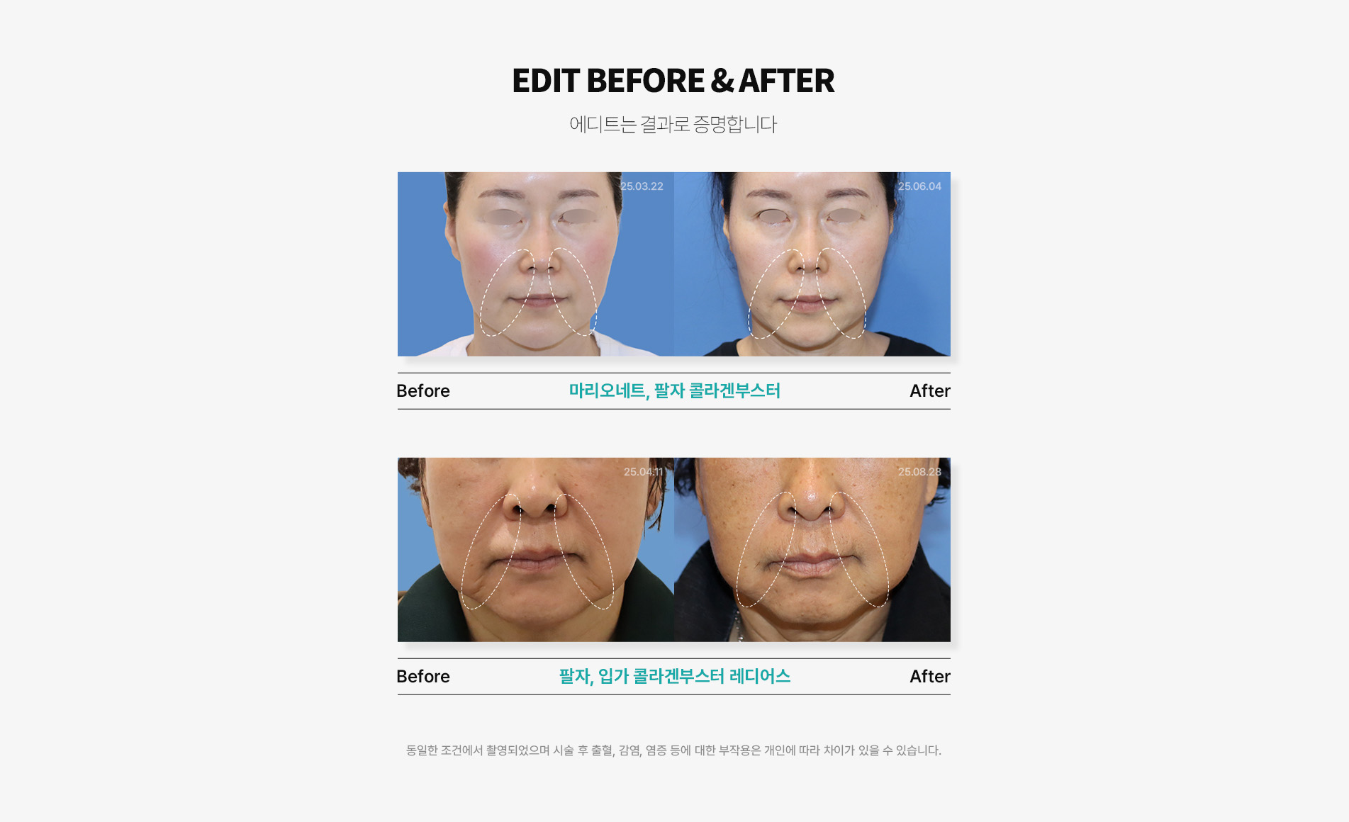 결과의 차이