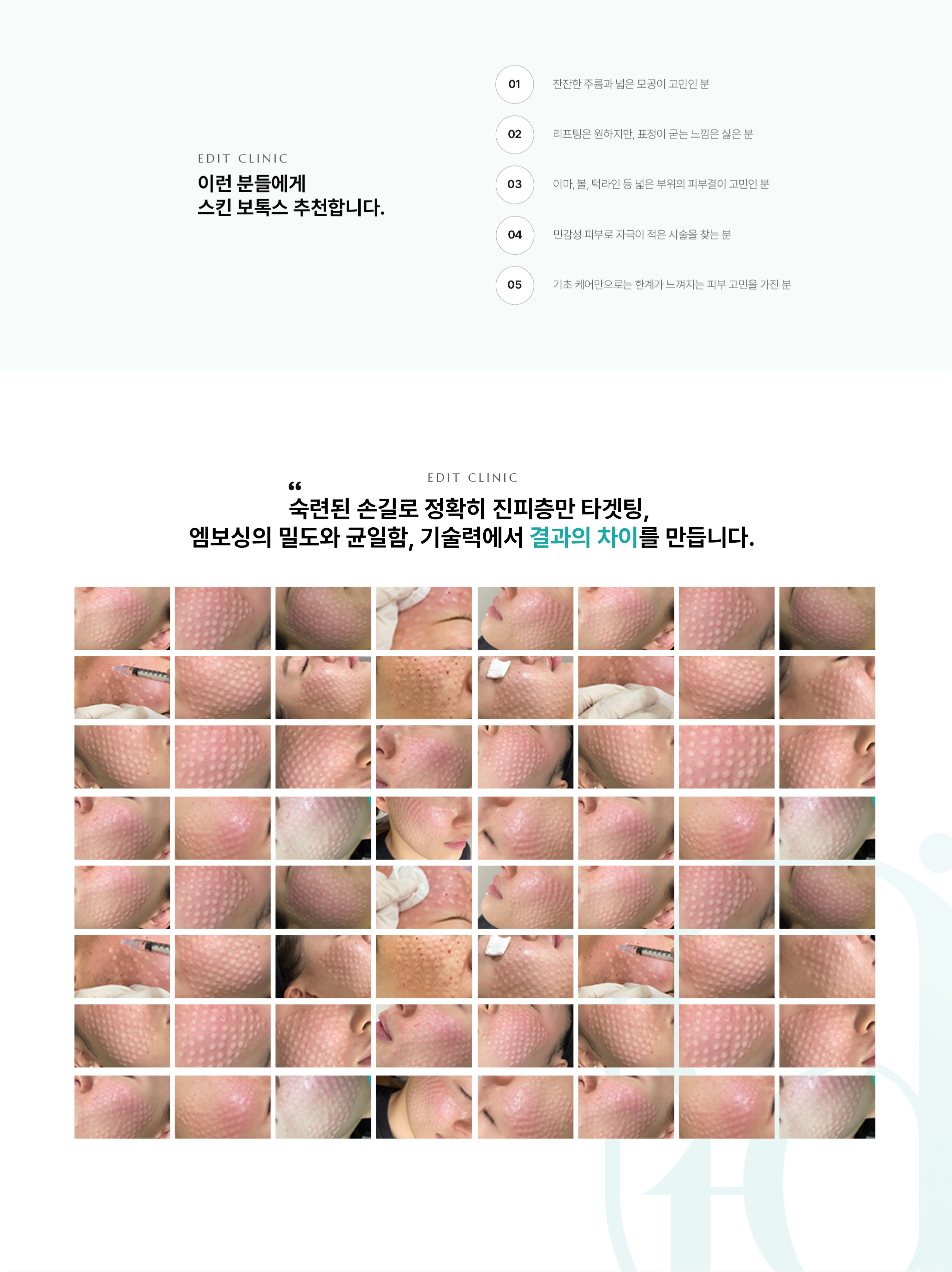 스킨보톡스 추천