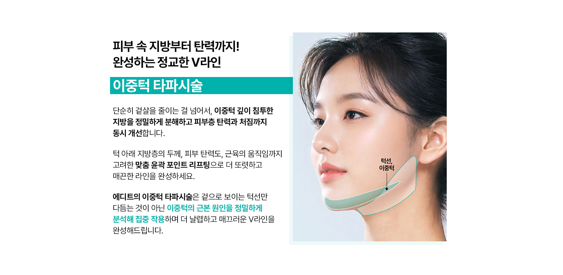이중턱 타파시술