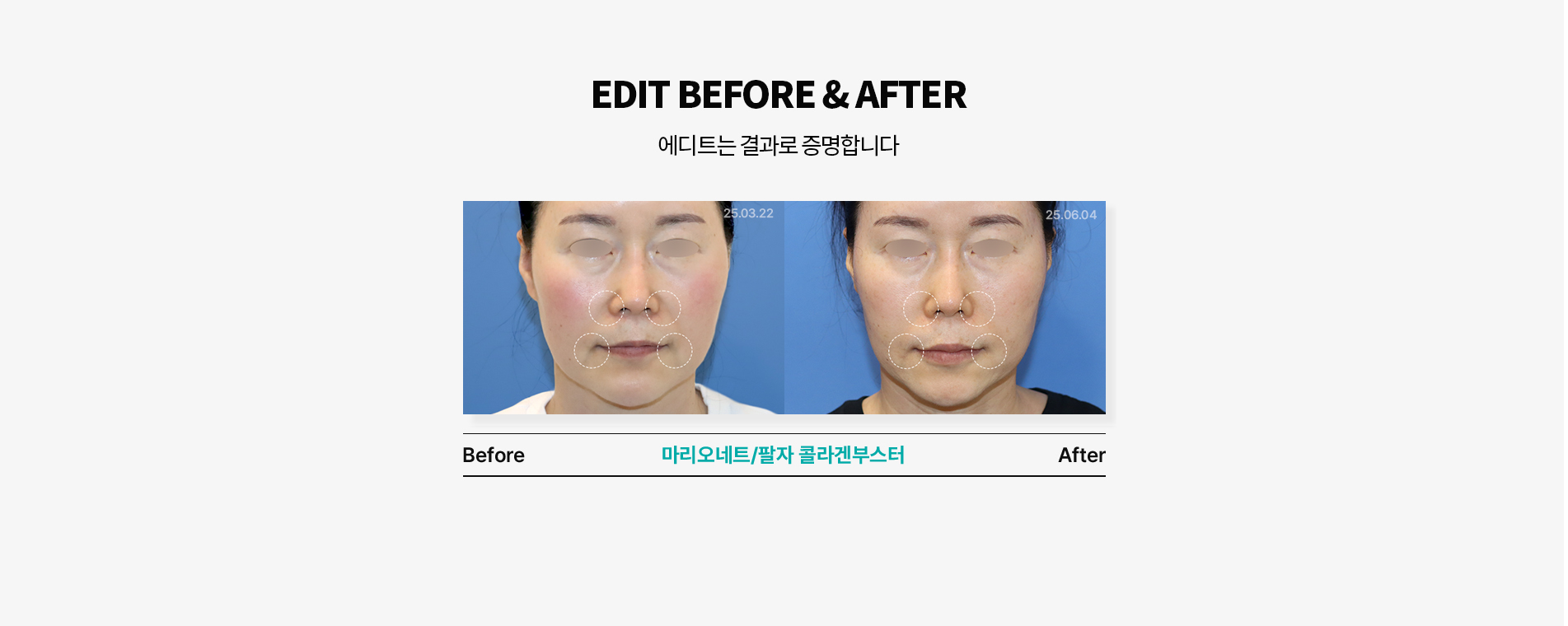 팔자동안패키지