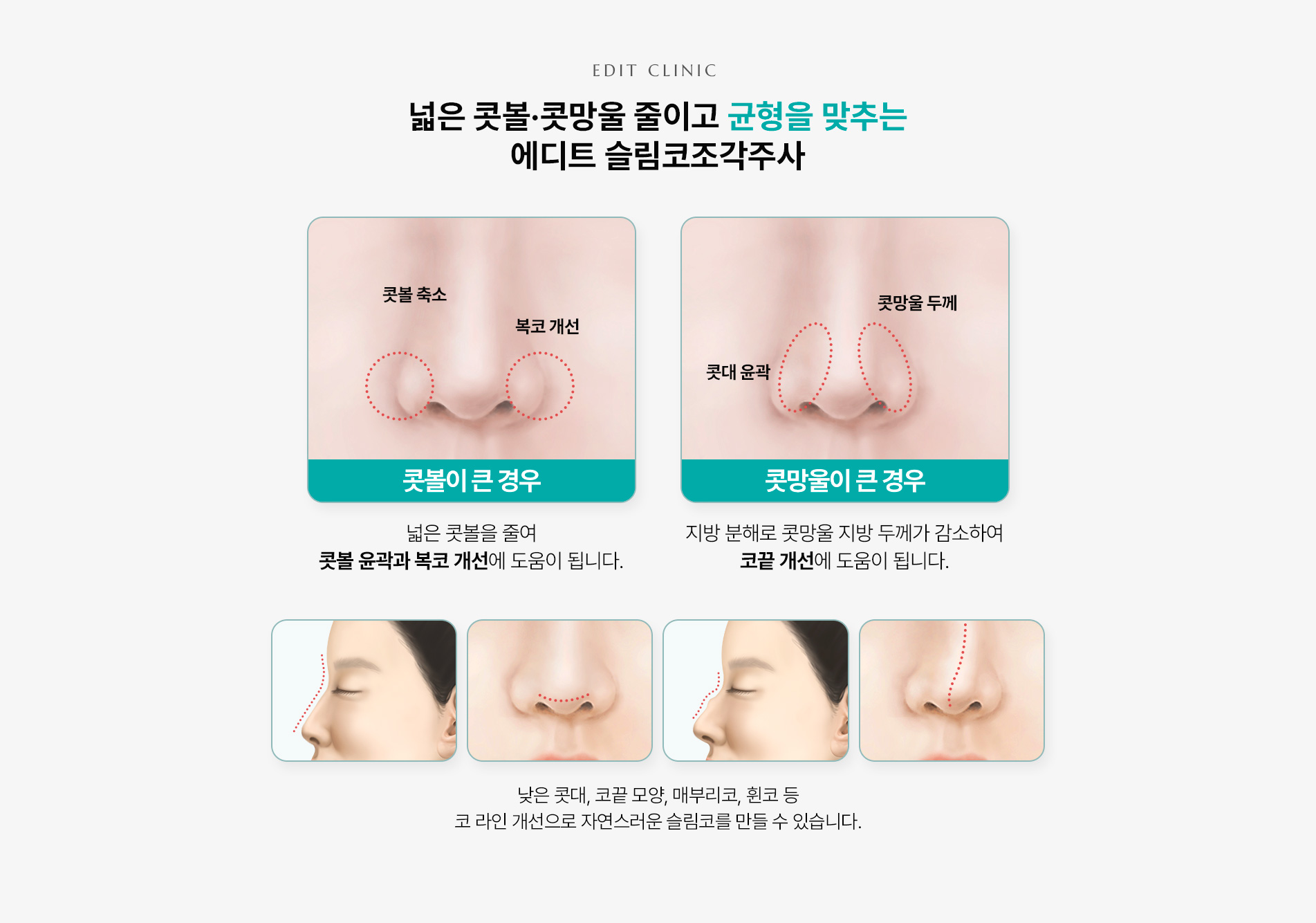 슬림코조각주사